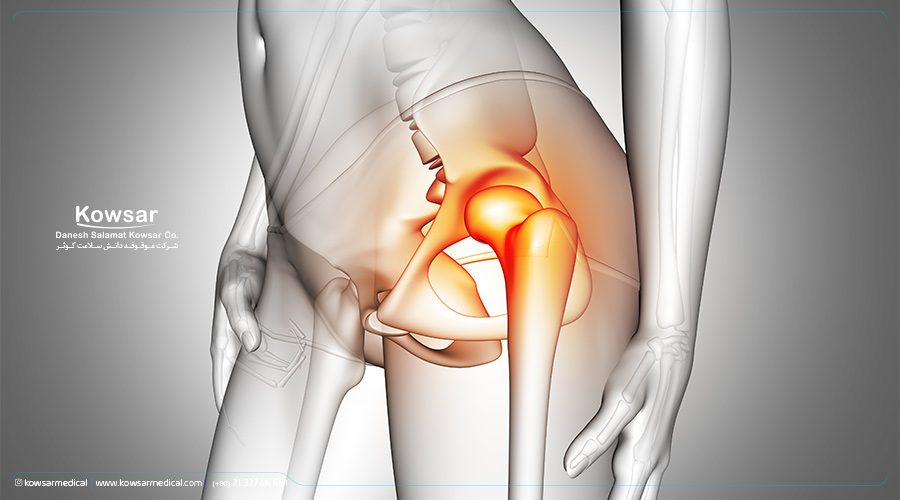 استخوان ران / femur/ و شکستگی آن